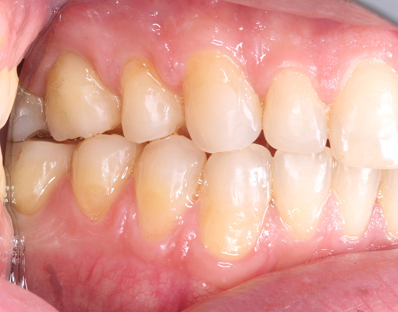 imagen-intraoral-santiago-de-los-caballeros